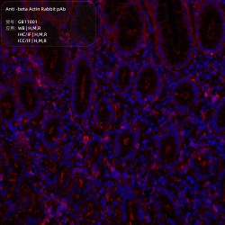 Anti -beta Actin Rabbit pAb 100 μL