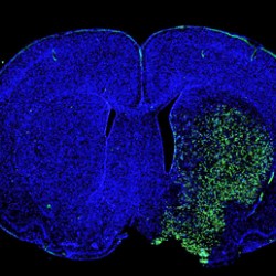 Fluorescein(FITC) Tunel Cell Apoptosis Detection Kit(50T)