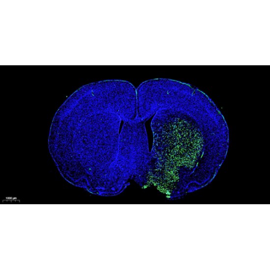 Fluorescein(FITC) Tunel Cell Apoptosis Detection Kit(50T)