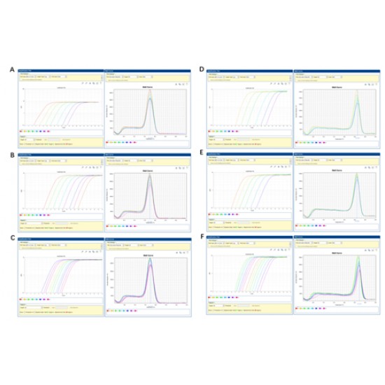 2 × SYBR Green qPCR Master Mix (High ROX) 1mL