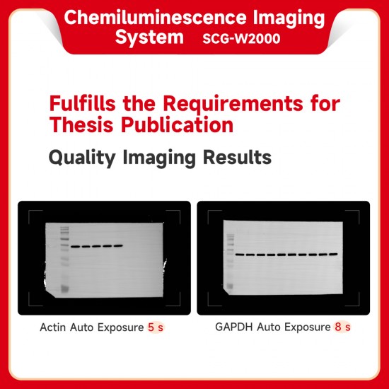 Chemiluminescence Imaging system